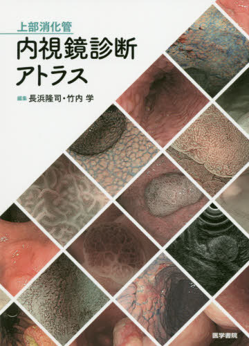 楽天市場】上部消化管内視鏡診断アトラスの通販