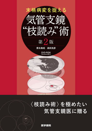 末梢病変を捉える気管支鏡“枝読み”術[本/雑誌] / 栗本典昭/著 森田克彦/著
