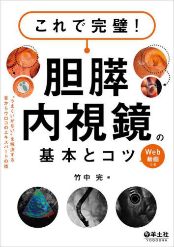 これで完璧!胆膵内視鏡の基本とコツ “うまくいかない”を解決する目からウロコのエキスパートの技 Web動..