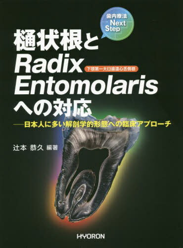 ご注文前に必ずご確認ください＜商品説明＞＜収録内容＞1 樋状根(なぜ、樋状根の治療は難しいのか?樋状根の解剖学的特徴樋状根への臨床対応とその考察樋状根における偶発症樋状根への外科的対応 ほか)2 Radix Entomolaris(なぜ、Radix Entomolarisの治療は難しいのか?下顎第一大臼歯のRadix Entomolarisの解剖学的特徴下顎第一大臼歯のRadix Entomolarisの病変Radix Entomolarisを持つ患歯への臨床対応とその考察)＜商品詳細＞商品番号：NEOBK-2835272Tsujimoto Yasuhisa / Hencho / Toi Jo Ne to RadixEntomolarisメディア：本/雑誌発売日：2023/02JAN：9784864320764樋状根とRadixEntomolaris[本/雑誌] / 辻本恭久/編著2023/02発売