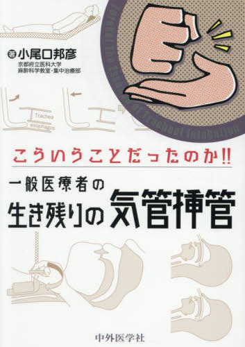 楽天市場】気管挿管（本・雑誌・コミック）の通販