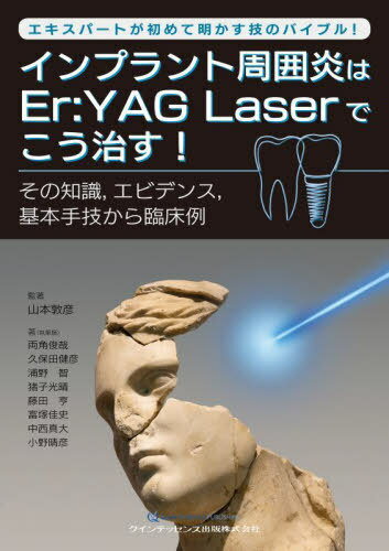 インプラント周囲炎はEr:YAG Laserでこう治す! エキスパートが初めて明かす技のバイブル! その知識 エビデンス 基本手技から臨床例[本/雑誌] / 山本敦彦/監著 両角俊哉/著 久保田健彦/著 浦野智/著 猪子光晴/著 藤田亨/著 富塚佳史/著 中西真大/著 小野晴彦/著
