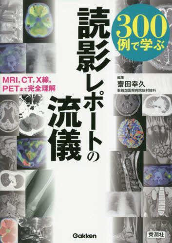 300ǳؤɱƥݡȤή MRI CT X PETޤǴ[/] / Ĺ/Խ