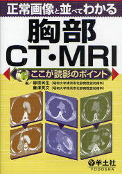 正常画像と並べてわかる胸部CT MRI 本/雑誌 (ここが読影のポイント) (単行本 ムック) / 櫛橋民生/編 藤沢英文/編