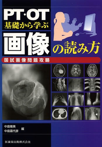 PT・OT基礎から学ぶ画像の読み方 国試画像問題攻略[本/雑誌] (単行本・ムック) / 中島雅美/編 中島喜代彦/編