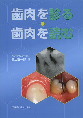歯肉を診る・歯肉を読む[本/雑誌] / 三上直一郎/著