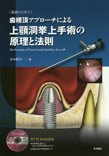 ご注文前に必ずご確認ください＜商品説明＞＜収録内容＞1 上顎骨・上顎洞の解剖と上顎洞の形態および生理2 経歯槽頂上顎洞挙上手術(TCMSL)の現状と分析3 経歯槽頂上顎洞挙上手術(TCMSL)4 RBHを基準にした手術法と推奨度5 インプラント安定指数と超音波刺激装置の関連性と意義6 インプラント周囲炎の起炎菌7 まとめと展望付録 Q&Aで学ぶこんなとき、どうする?＜商品詳細＞商品番号：NEOBK-1745211Muroki Toshimi / Cho / Shiso Itadaki Approach Niyoru Jogaku Hora Kyo Jo Shujutsu No Genri to Hosoku Kiso Kara Manabuメディア：本/雑誌重量：563g発売日：2014/08JAN：9784816012754歯槽頂アプローチによる上顎洞挙上手術の原理と法則 基礎から学ぶ[本/雑誌] / 室木俊美/著2014/08発売