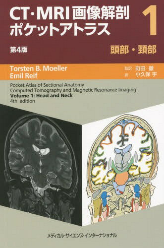 CT・MRI画像解剖ポケットアトラス 1 / 原タイトル:Pocket Atlas of Sectional Anatomy.Volume1:Head and Neck 原著第4版の翻訳 / トルステンB.メーラー/著 エミールレイフ/著 町田徹/監訳