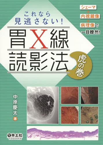これなら見逃さない!胃X線読影法虎の巻 シェーマ+内視鏡像+病理像で一目瞭然![本/雑誌] / 中原慶太/著