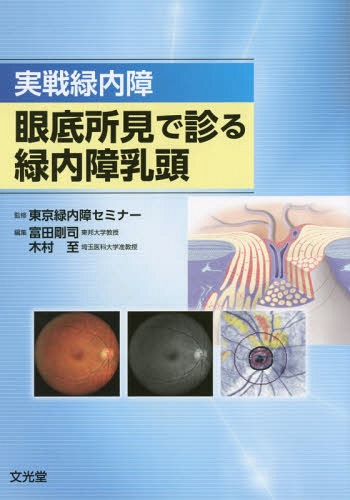 実戦緑内障眼底所見で診る緑内障乳頭[本/雑誌] / 東京緑内障セミナー/監修 富田剛司/編集 木村至/編集