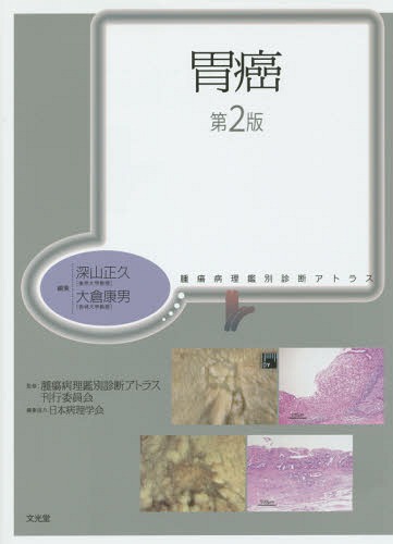 脳腫瘍 | 株式会社文光堂