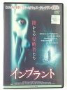 ZD43012【中古】【DVD】インプラント