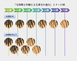 Jo-Ju REDスカルプローション 100ml 【薬用育毛剤】2本セット