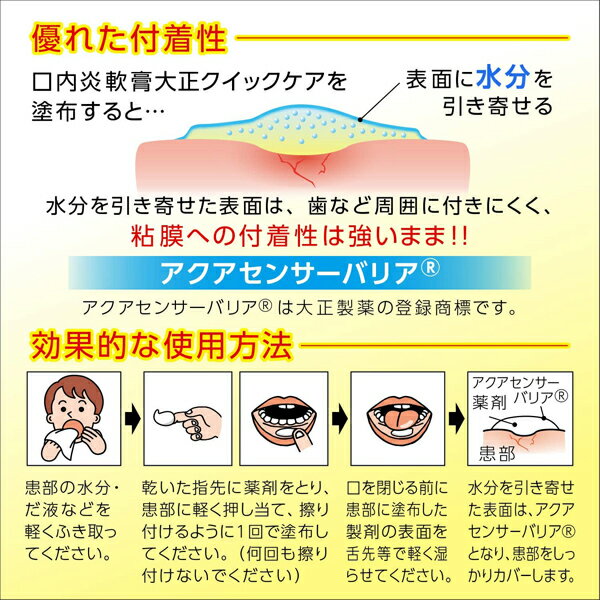 ★ 【第(2)類医薬品】 口内炎軟膏 大正クイックケア 5g セルフメディケーション税制対象商品 大正製薬 3