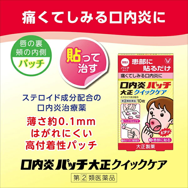 ★ 【第(2)類医薬品】 口内炎パッチ大正クイックケア 10枚(パッチ) セルフメディケーション税制対象商品 大正製薬 (2)
