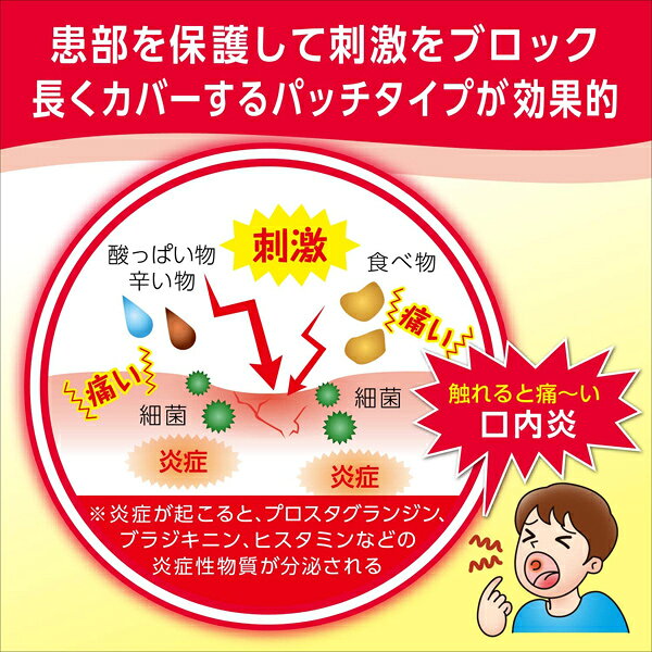 ★ 【第(2)類医薬品】 口内炎パッチ大正クイックケア 10枚(パッチ) セルフメディケーション税制対象商品 大正製薬 (3)