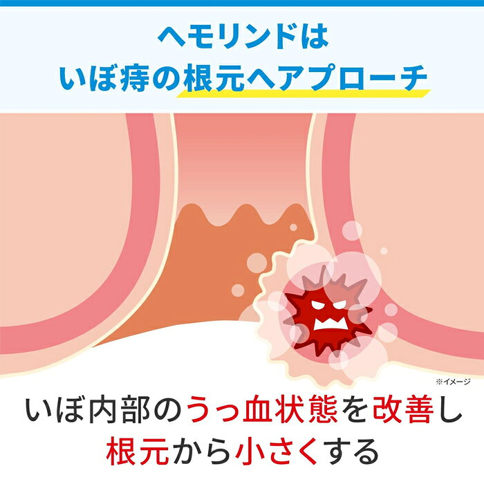 【第2類医薬品】ヘモリンド舌下錠 20錠 小林製薬