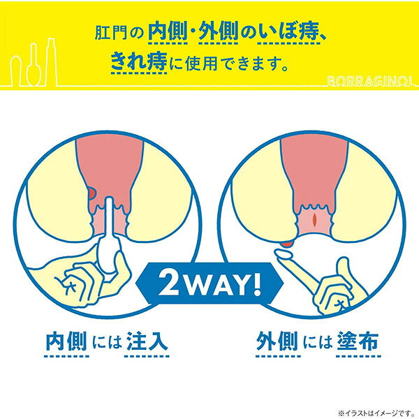 ＜2028年9月期限・送料無料＞【第(2)類医薬品】 ボラギノールA注入軟膏 2g×30個入 天籐製薬 nice-10025765 ナイスドラッグ サンプル画像3