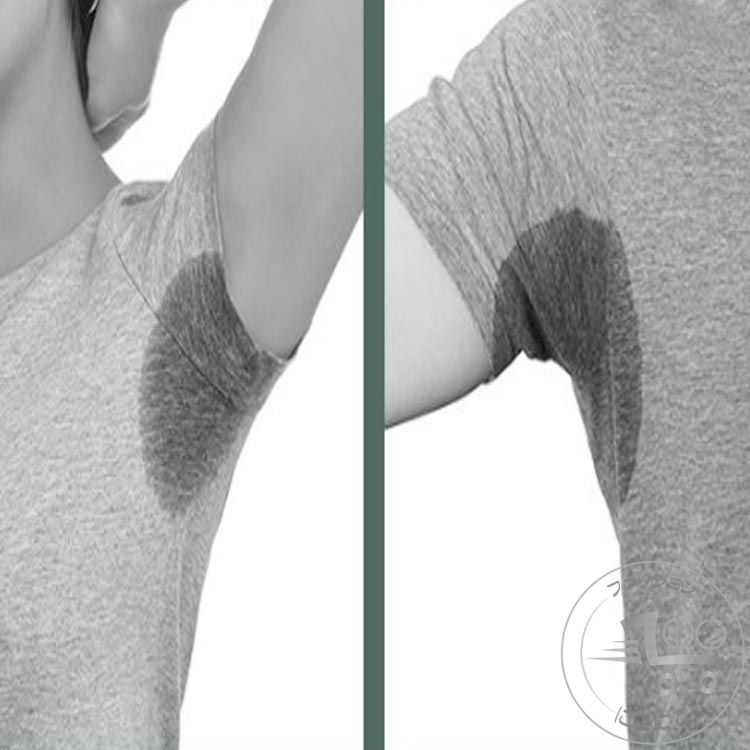 新生活 汗脇パット 50枚セット 汗取りパット メンズ レディース 汗わきパット 汗わきパッド ワキ 汗対策 汗染み防止 吸水 速乾 汗脇パッド 脇汗パッド 汗...