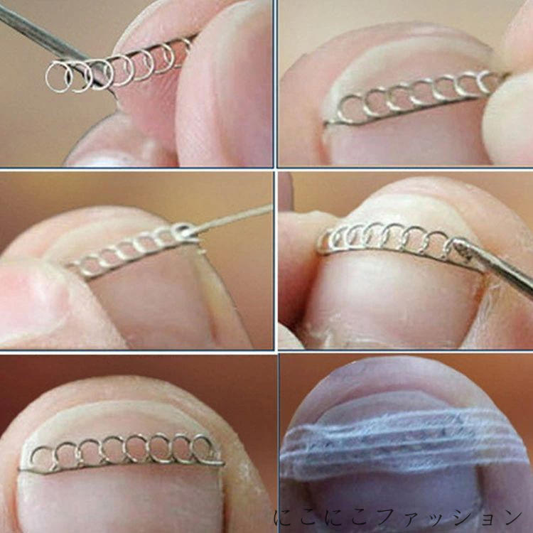 新生活 セルフケア テープ 足の巻き爪 12個セット 爪ワイヤー 巻き爪 矯正 爪切り 矯正器具 巻き爪 巻き爪チェーン 巻き爪矯正グッズ テーピング ガード ...