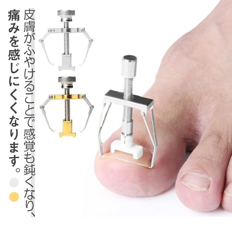 陥入爪 5個セット！矯正 ツール 巻爪ケア 防止 矯正 巻き爪 セルフケア 5個セット！矯正 巻爪 ネイルケ..