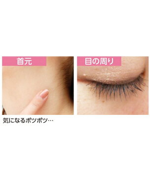 薬用プッチフラットクリームEX コスメ スキンケア ニッセン nissen