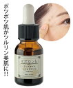 イポロンL 1本 ニッセン nissen