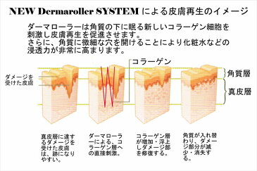 【1年保証】ボディ用ダーマローラー 0.25mm医療用チタン針1200本 自宅で簡単に使用できます【日本語説明書付】【送料無料】【美顔ローラー】【美顔器】【シミ くすみ たるみ キズ跡 ニキビ跡 デコボコ肌 クレーター肌 シワ ほうれい線 妊娠線 お尻の黒ずみ 育毛 養毛】