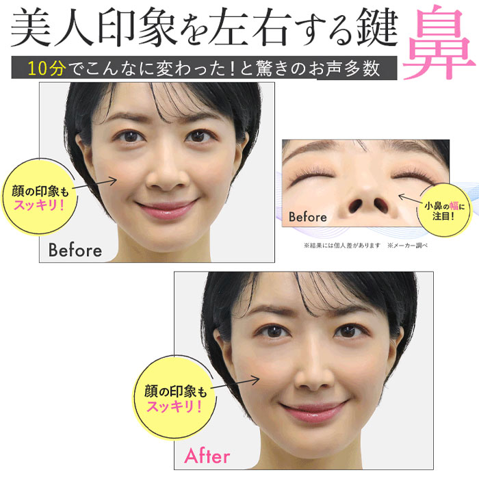 LUXCEAR Fornez / ルクセア フォーネス 【送料無料】［鼻用 EMSマシン 美顔器 鼻専用]