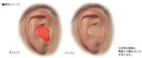 耳せんです。 アメリカ環境庁認定の防音性能(騒音低下22db)、安全無害なシリコン製です。 携帯に便利なプラスチックケース入り、肌色と同じベージュ、スポーティーなフラッシュオレンジの2色のカラーから選べます。 旅行時のいびき防止だけでなく、水を完全シャットアウトする防水機能があるので、あらゆるスポーツシーンにも最適 サイズ:(本体)2cm、(厚さ)0.8cm 重量:4g 4個入り 材質:シリコン アメリカ製 カラー：オレンジ、ベージュ、ホワイト メール便不可