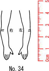 人体図スタンプ ゴム印　医療用　カルテ　【腕　外側】34