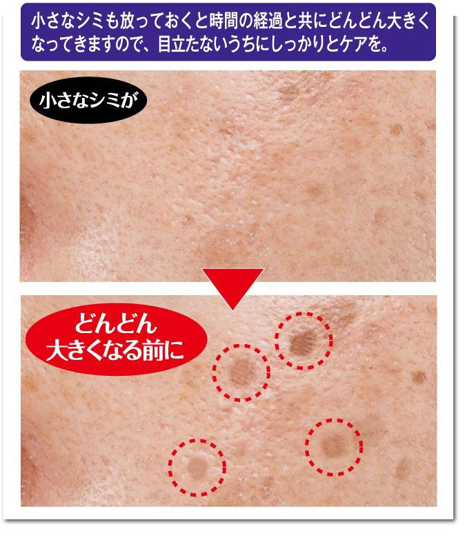 お得な2本セット お休み中に徹底ケア シミダスパック 30g 医薬部外品