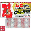 【第2類医薬品】【送料無料(ゆうパケット)】ムヒAZ錠 12錠 池田模範堂【セルフメディケーション税制対象】【大】