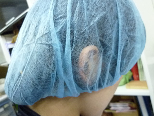 ����å��� �ե�����󥰥�å����ؤ�Ƭȱ����ʪ�����ɻߡ۶�̳�ѥإ�������å� ���ݽ�