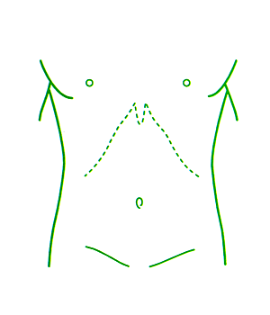 シャチハタ角型印　医療用人体図　胴体20×30mm