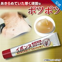 【送料無料】【 イボンヌ クリーム プレミアム 20g 】 イボ いぼ IBO ibo 首イボ イボ取り クリーム いぼ取り 首 いぼ取りクリーム イボとり い...