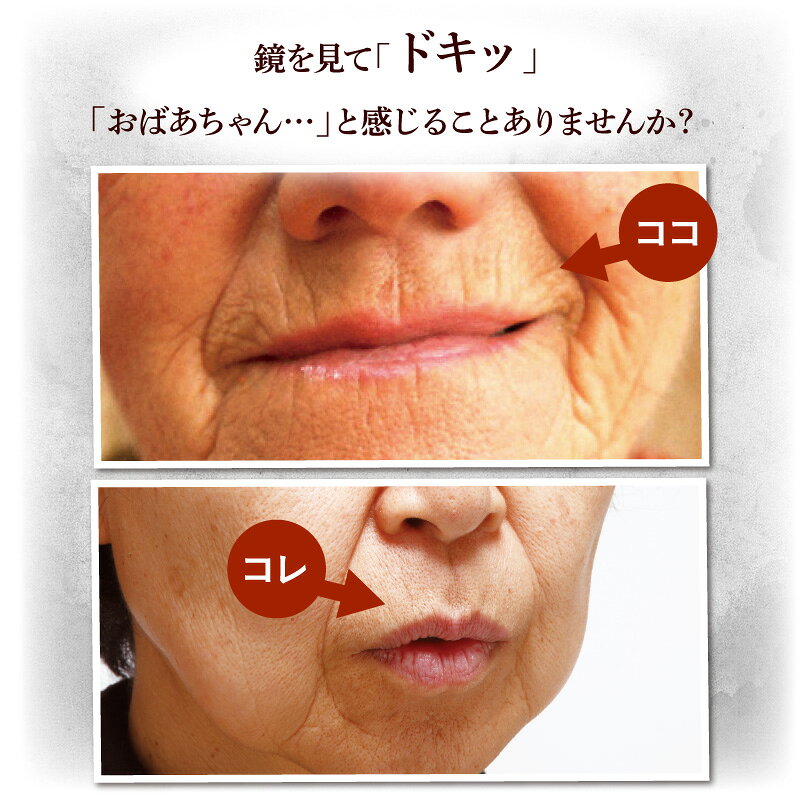 薬用シワトリンクル しわ改善 シワ取りクリーム 薬用 シワ 口元 目元 ほうれい線 縦ジワ シワ対策 シワケア 医薬部外品 エイジングケア スキンケア 美容液 極細ノズル 直塗り シワ集中ケア シワが気になる シワ 口元ケア 老け顔 改善クリーム ovrtk-10003186 【ビューティー ウォーカー】 サンプル画像3