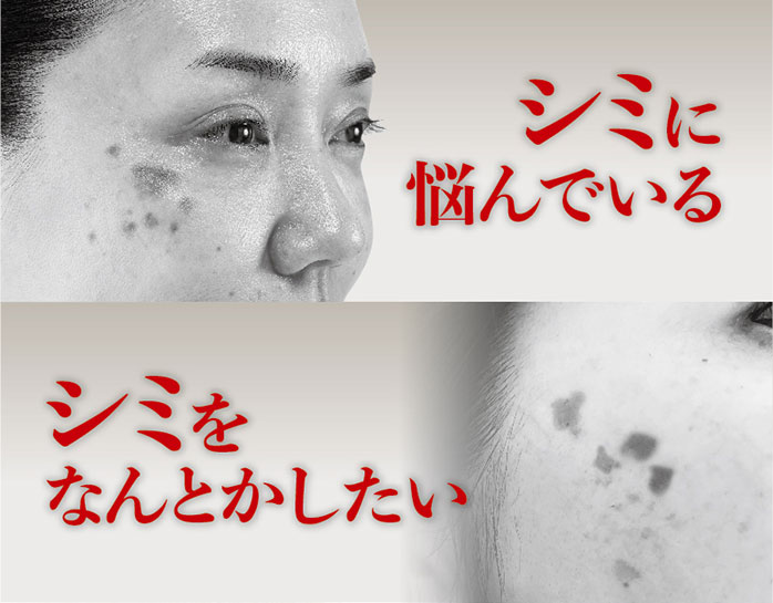 メーカー正規品 しみ 改善 美容液 しみとり シミ取りクリーム 黒ずみ クリーム ヒト幹細胞培養液 アンチエイジング ハトムギ プラセンタ 美女クリエイト コクハンパックン ナイトリッチ ovrtk-10001667 【ビューティー ウォーカー】 サンプル画像2