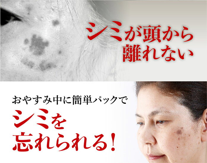 メーカー正規品 しみ 改善 美容液 しみとり シミ取りクリーム 黒ずみ クリーム ヒト幹細胞培養液 アンチエイジング ハトムギ プラセンタ 美女クリエイト コクハンパックン ナイトリッチ ovrtk-10001667 【ビューティー ウォーカー】 サンプル画像3