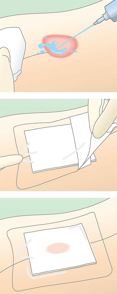 thum3