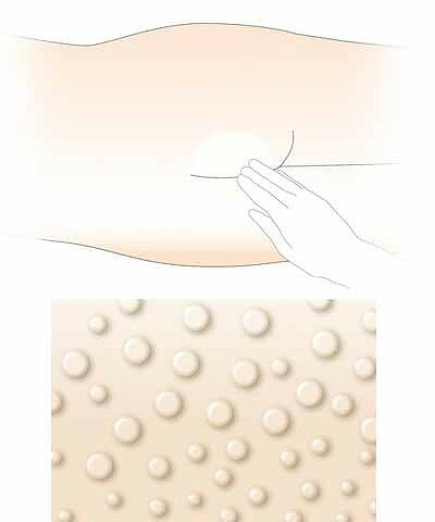 �����󥱥����꡼�� ��⥤���Хꥢ �쥮��顼 18031 160g ���륱���å���Ĥ��֤� ���� �ɷ� ����ʪ ������ �ݸ��� �໤ �ݼ���ʬ�۹� ����� �ݼ� �Ϥÿ�