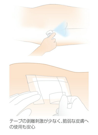 リモイスコート スプレータイプ 30mL 17711 アルケア │ 皮膚保護剤 スプレー式 日本製 介護用品 高齢者 お年寄り 老人 シニア 病院 老人ホーム デイサービス 福祉施設 介護施設 在宅介護