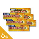 【6個】『ボルカインA軟膏25g』痔の薬 外用タイプ|外痔核の痛み・かゆみを鎮める|リドカイン配合でつらい症状に即効ケア 【第(2)類医薬品】
