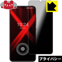 Privacy Shieldy`h~E˒ጸzیtB UMIDIGI X { А