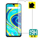 9HdxyzیtB UMIDIGI A7 Pro (Oʂ̂) { А