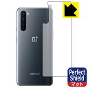 Perfect Shield OnePlus Nord (wʂ̂) { А