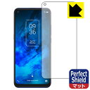 Perfect Shield TCL10 5G (T790H) Oʂ̂ (3Zbg) { А