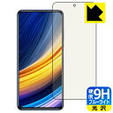 9Hdxyu[CgJbgzیtB Xiaomi POCO X3 Pro { А