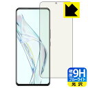 9Hdxyu[CgJbgzیtB ZTE Axon 30 ywFؑΉz { А