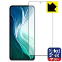 Perfect Shield Xiaomi Mi 11i (Oʂ̂) { А